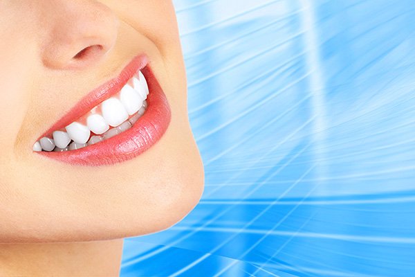 Teeth Whitening Options From A Cosmetic Dentist In Johns Creek