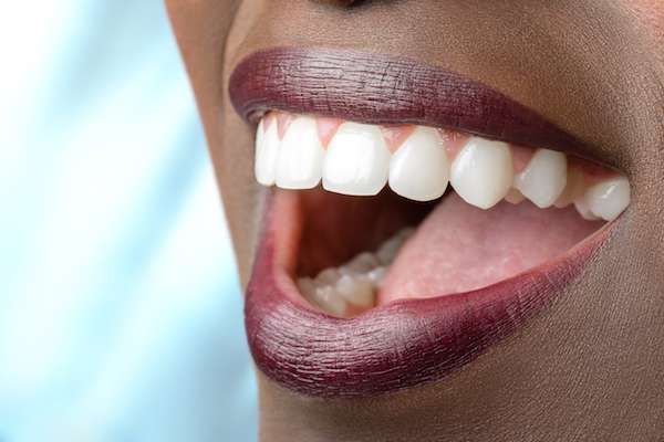 Routine Dental Care: What Are Tooth Colored Fillings from Parsons Pointe Dental Care in Johns Creek, GA